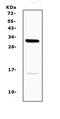 Inhibitor Of DNA Binding 2 antibody, A00417-1, Boster Biological Technology, Western Blot image 