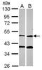 PPOX antibody, GTX106163, GeneTex, Western Blot image 