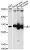Carbonic Anhydrase 7 antibody, LS-C749361, Lifespan Biosciences, Western Blot image 