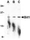 Peptidyl-TRNA Hydrolase 2 antibody, TA306251, Origene, Western Blot image 