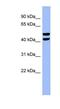 6-Phosphofructo-2-Kinase/Fructose-2,6-Biphosphatase 4 antibody, NBP1-57620, Novus Biologicals, Western Blot image 