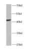 n-myc antibody, FNab05460, FineTest, Western Blot image 