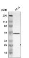 Zinc Finger FYVE-Type Containing 1 antibody, HPA002898, Atlas Antibodies, Western Blot image 