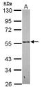 Pregnancy Specific Beta-1-Glycoprotein 9 antibody, GTX119968, GeneTex, Western Blot image 
