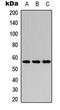 Cytochrome P450 Family 2 Subfamily C Member 8 antibody, orb315769, Biorbyt, Western Blot image 