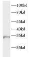 ELMO Domain Containing 2 antibody, FNab02744, FineTest, Western Blot image 