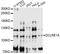 DNA Cross-Link Repair 1A antibody, LS-C749317, Lifespan Biosciences, Western Blot image 