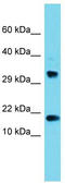 Cleavage And Polyadenylation Specific Factor 4 Like antibody, TA335900, Origene, Western Blot image 