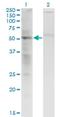 SS18 Subunit Of BAF Chromatin Remodeling Complex antibody, H00006760-M07, Novus Biologicals, Western Blot image 