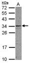 Coiled-Coil Domain Containing 107 antibody, LS-C155614, Lifespan Biosciences, Western Blot image 