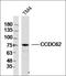 Harakiri, BCL2 Interacting Protein antibody, orb182452, Biorbyt, Western Blot image 