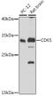 Cyclin Dependent Kinase 5 antibody, 19-820, ProSci, Western Blot image 