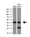 Branched Chain Amino Acid Transaminase 1 antibody, NBP2-01826, Novus Biologicals, Western Blot image 