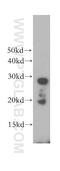 Ras-related protein Rab-34 antibody, 12378-1-AP, Proteintech Group, Western Blot image 