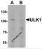 Unc-51 Like Autophagy Activating Kinase 1 antibody, 7335, ProSci Inc, Western Blot image 