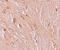 Zinc Finger And BTB Domain Containing 3 antibody, A14164, Boster Biological Technology, Immunohistochemistry paraffin image 