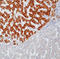 Hepatitis B Virus antibody, LS-C88067, Lifespan Biosciences, Immunohistochemistry paraffin image 
