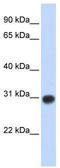 Zinc Finger MYND-Type Containing 19 antibody, TA339791, Origene, Western Blot image 