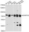 ADAM Metallopeptidase With Thrombospondin Type 1 Motif 4 antibody, MBS128872, MyBioSource, Western Blot image 