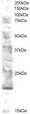 Ubiquitin Conjugating Enzyme E2 V2 antibody, TA302785, Origene, Western Blot image 