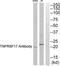CD269 antibody, TA311846, Origene, Western Blot image 