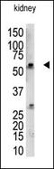 RANBP2-Type And C3HC4-Type Zinc Finger Containing 1 antibody, 61-073, ProSci, Western Blot image 