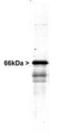 Internexin Neuronal Intermediate Filament Protein Alpha antibody, GTX30195, GeneTex, Western Blot image 