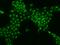 Testis Associated Actin Remodelling Kinase 2 antibody, 204679-T02, Sino Biological, Immunohistochemistry paraffin image 