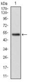 Glutathione S-Transferase Mu 1 antibody, AM06706SU-N, Origene, Western Blot image 