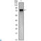 Fms Related Tyrosine Kinase 4 antibody, LS-C812602, Lifespan Biosciences, Western Blot image 