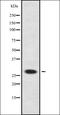 Neurogenin 2 antibody, orb336997, Biorbyt, Western Blot image 