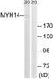 Myosin Heavy Chain 14 antibody, TA315804, Origene, Western Blot image 