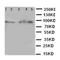 Homeobox A6 antibody, orb76119, Biorbyt, Western Blot image 