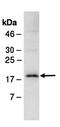 Fanconi anemia group I protein antibody, orb66888, Biorbyt, Western Blot image 