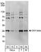 Casein kinase II subunit beta antibody, A301-983A, Bethyl Labs, Western Blot image 