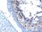 VPS28 Subunit Of ESCRT-I antibody, LS-C55673, Lifespan Biosciences, Immunohistochemistry paraffin image 