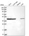 Succinate-CoA Ligase ADP-Forming Beta Subunit antibody, HPA039536, Atlas Antibodies, Western Blot image 