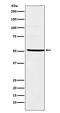 Nuclear Receptor Subfamily 5 Group A Member 1 antibody, M00891-1, Boster Biological Technology, Western Blot image 