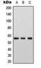 Growth Hormone 1 antibody, orb234861, Biorbyt, Western Blot image 
