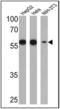Prolyl 4-Hydroxylase Subunit Beta antibody, NB300-517, Novus Biologicals, Western Blot image 