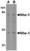 Solute Carrier Family 9 Member A1 antibody, orb74905, Biorbyt, Western Blot image 