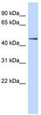 Zinc Finger Protein 391 antibody, TA331098, Origene, Western Blot image 