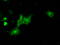 Atrial natriuretic peptide receptor 3 antibody, LS-C115118, Lifespan Biosciences, Immunofluorescence image 