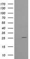 UMP/CMPK antibody, TA505409AM, Origene, Western Blot image 