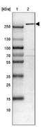 NCOA6 antibody, NBP1-89193, Novus Biologicals, Western Blot image 