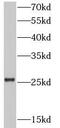 Fas Associated Via Death Domain antibody, FNab02941, FineTest, Western Blot image 