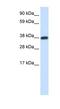 Doublesex- and mab-3-related transcription factor C2 antibody, NBP1-80248, Novus Biologicals, Western Blot image 