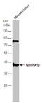 NADH dehydrogenase [ubiquinone] 1 alpha subcomplex subunit 10, mitochondrial antibody, GTX103093, GeneTex, Western Blot image 