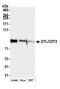 Denticleless protein homolog antibody, A300-948A, Bethyl Labs, Western Blot image 