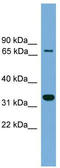 Brevican antibody, TA344597, Origene, Western Blot image 